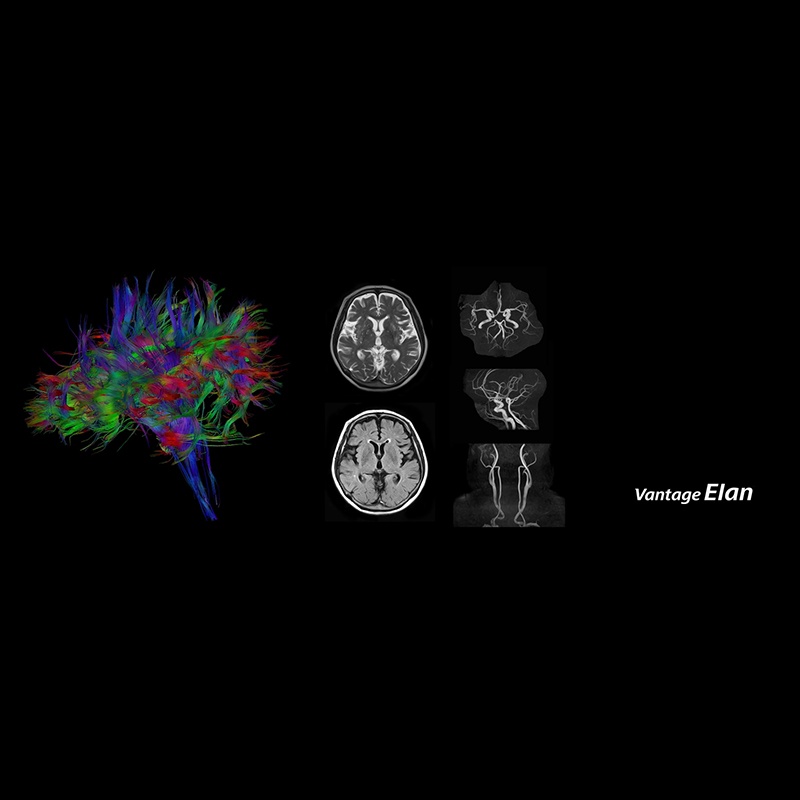 Магнитно-резонансный томограф Canon Vantage Elan